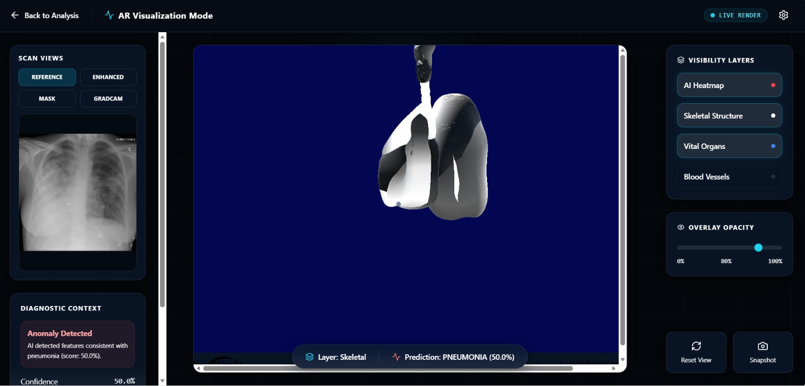 Xpert Interface Demo